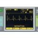 Дефібрилятор-монітор REANIBEX 700, Osatu, (Bexen Cardio), (Іспанія)